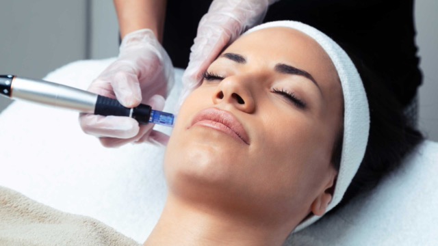 Microneedling Newcastle